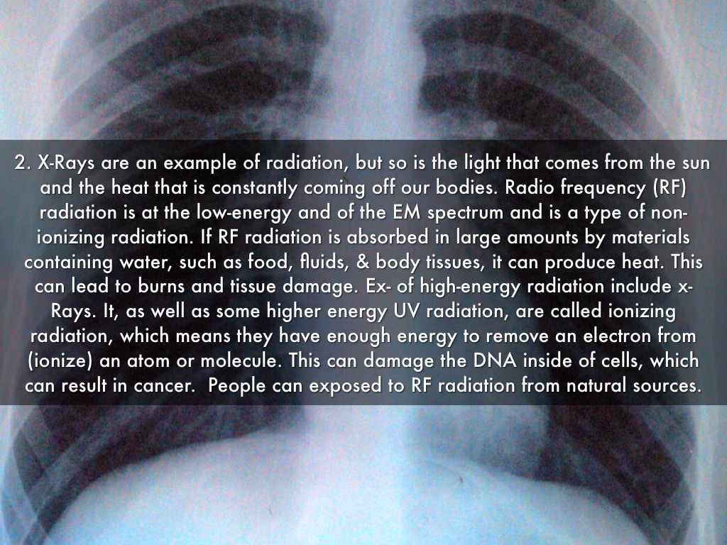 What Are Two Ways That Radio Waves And XRays Are Similar at Shelly