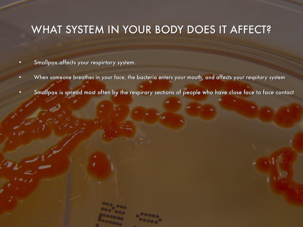 Small Pox by Jaylen Mahoney