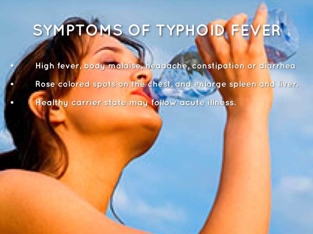 Common Communicable Diseases by Francis Villarante Rn