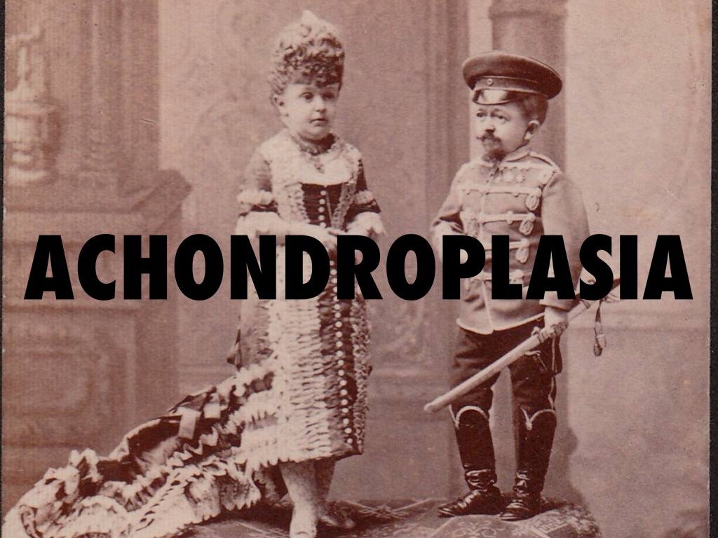 Achondroplasia 