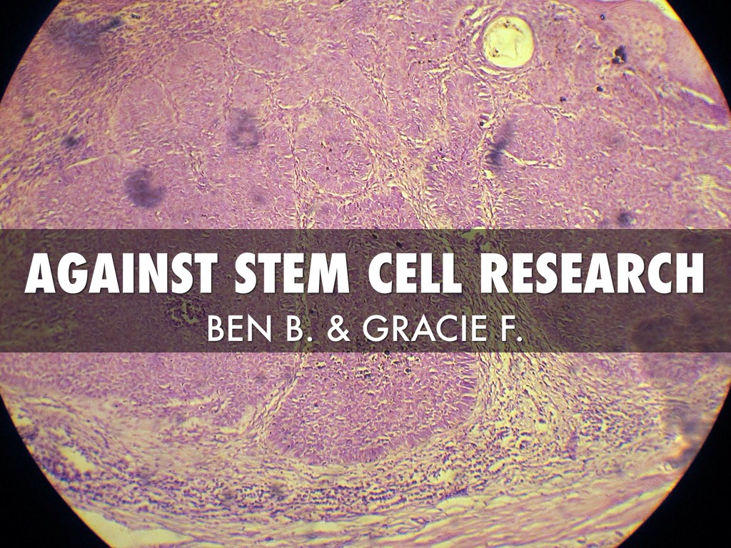 article against stem cell research