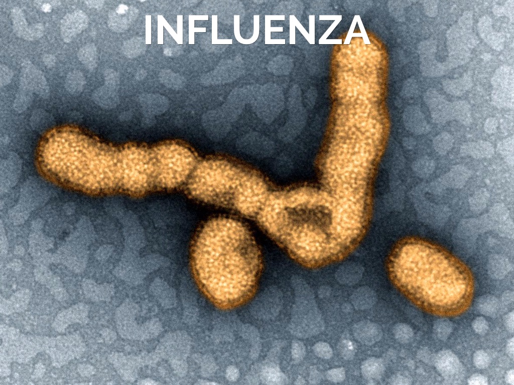 Influenza