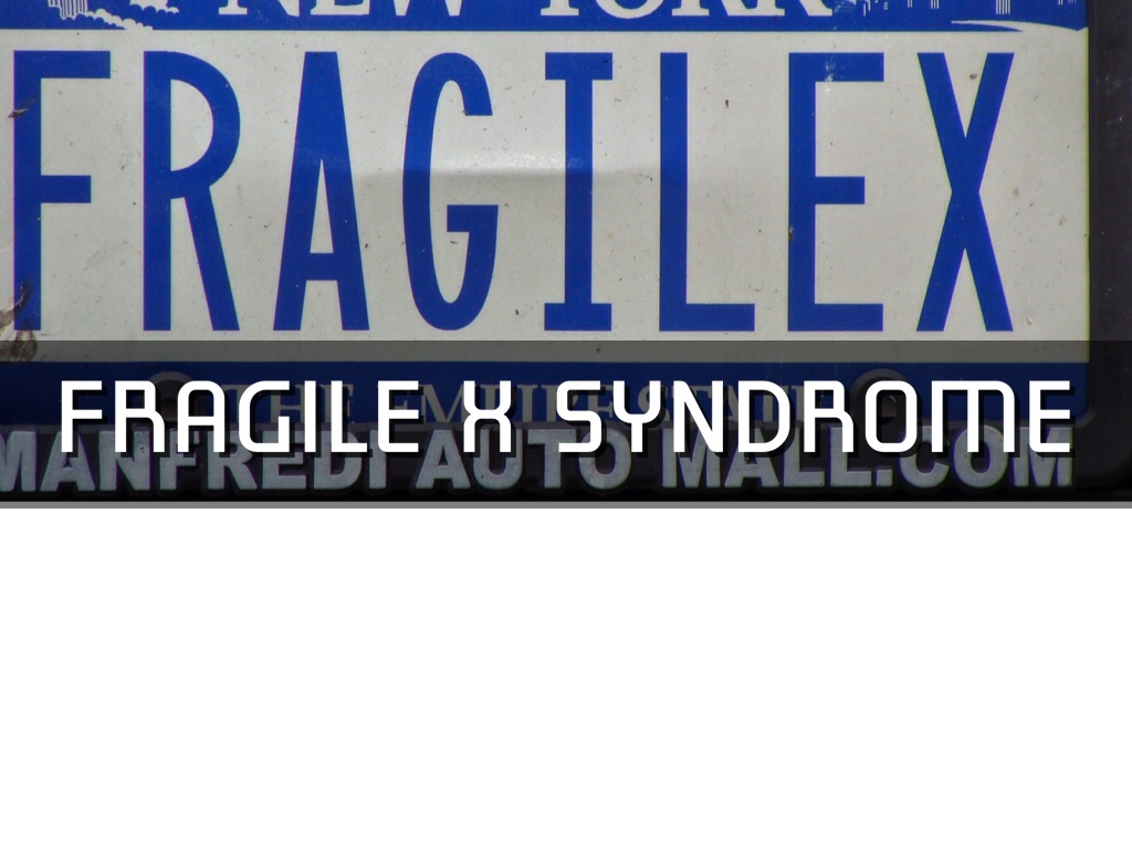 Fragile X Syndrome