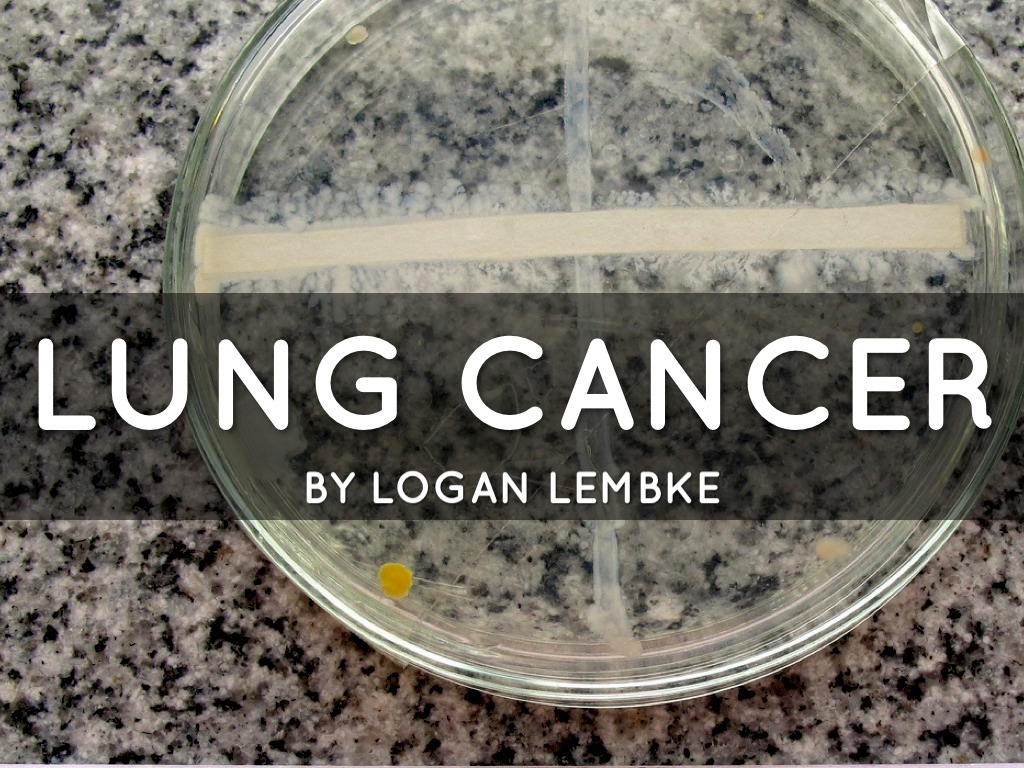Lung Cancer