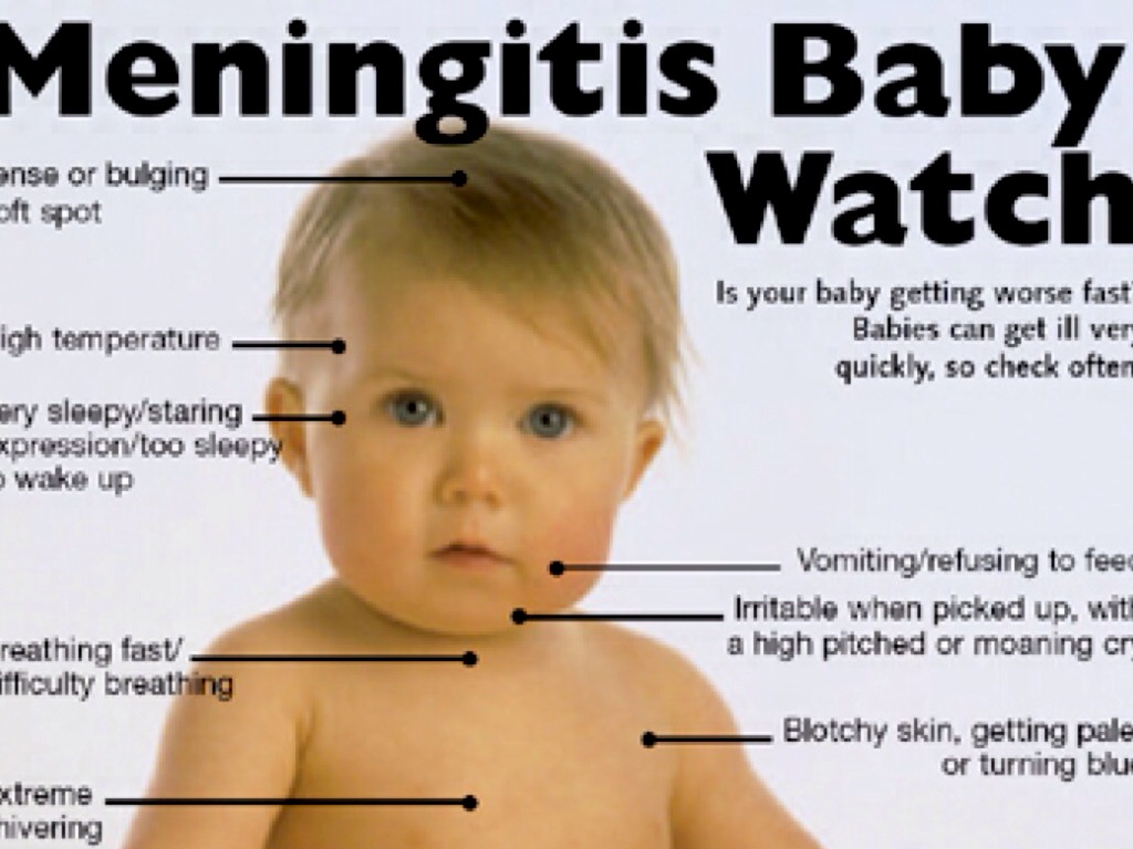 Meningitis By Samantha urias
