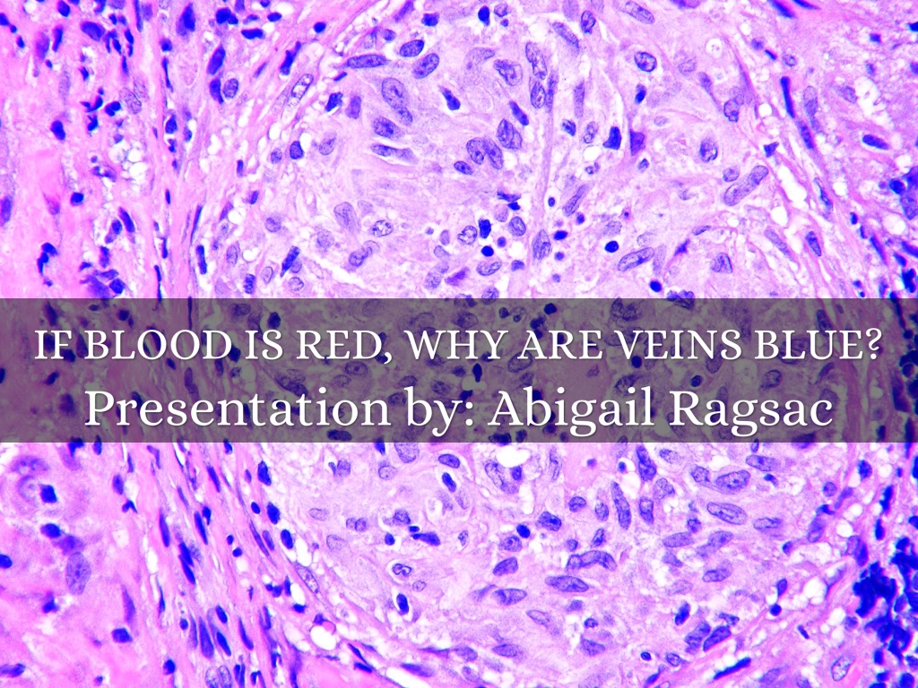 Copy of If Blood Is Red,Why Are Veins Blue?