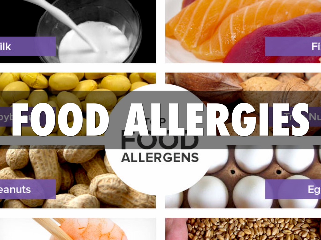 food allergies by Cole Lusk