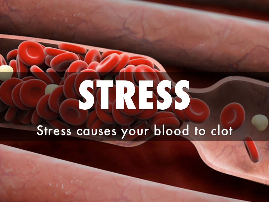 Stress by Johnny Feldman