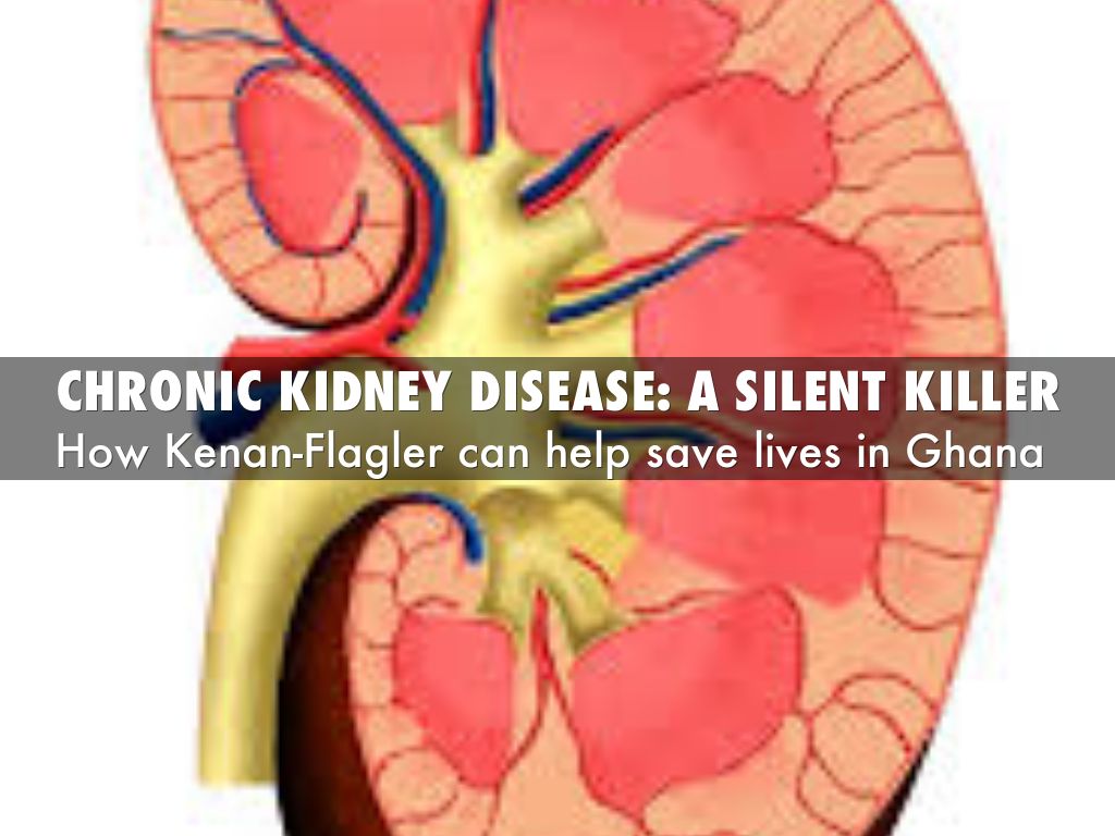 Chronic kidney disease: a silent killer
