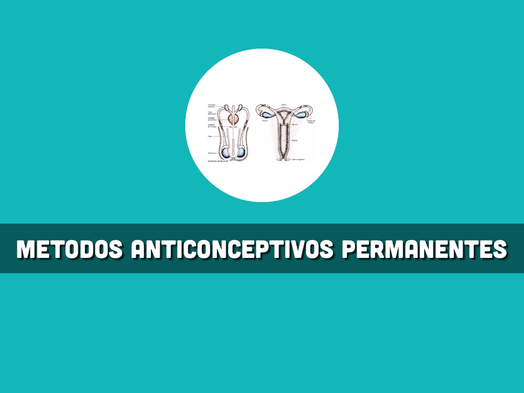 ventajas y desventajas de vasectomia y salpingoclasia ventajas y desventajas de vasectomia y salpingoclasia