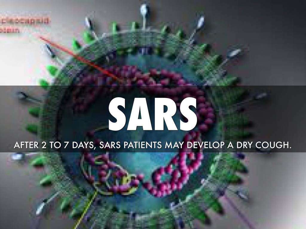 SARS 