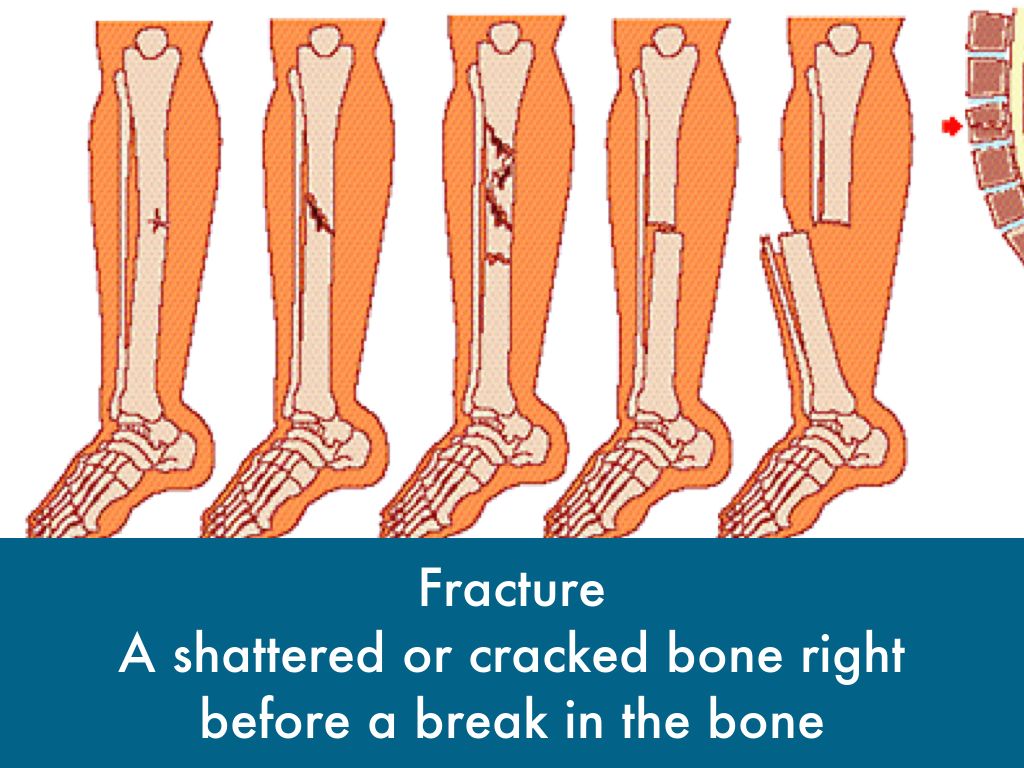 Title by Hailey Dawson