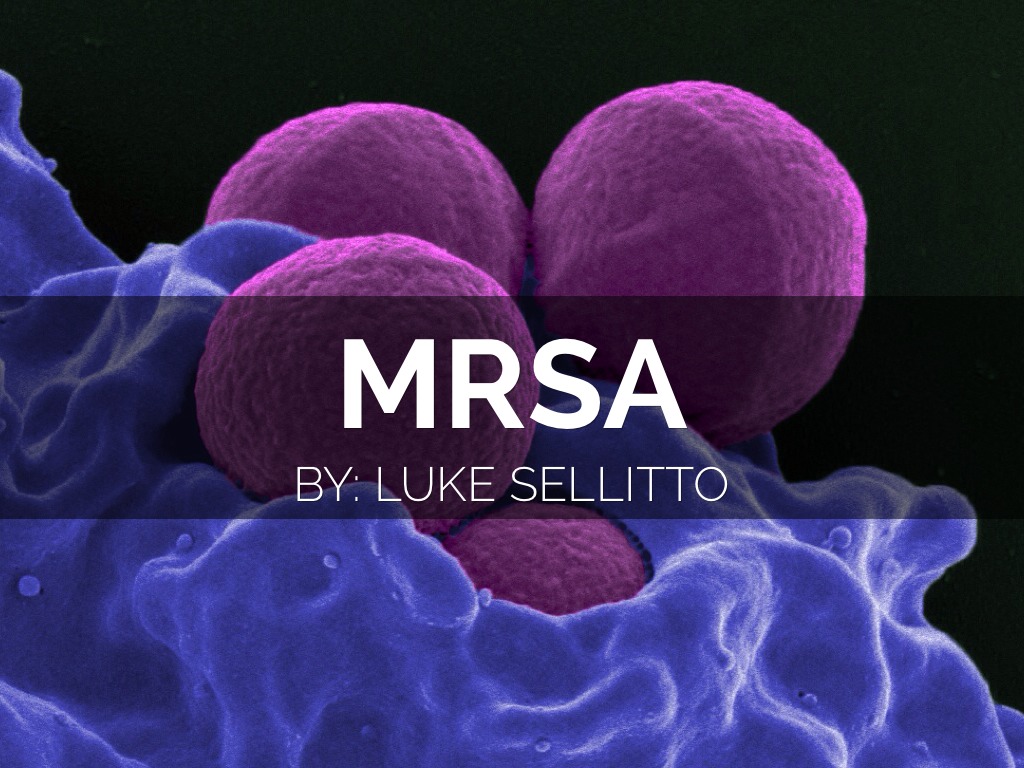 MRSA by Luke Sellitto
