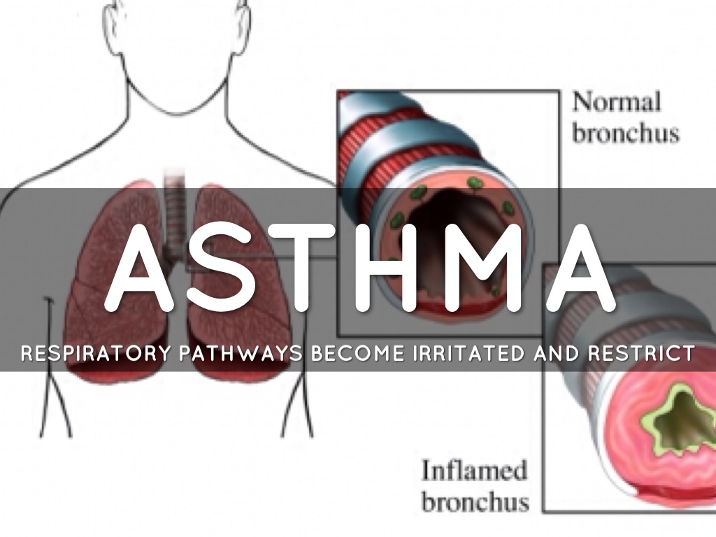 Respiratory System Diseases