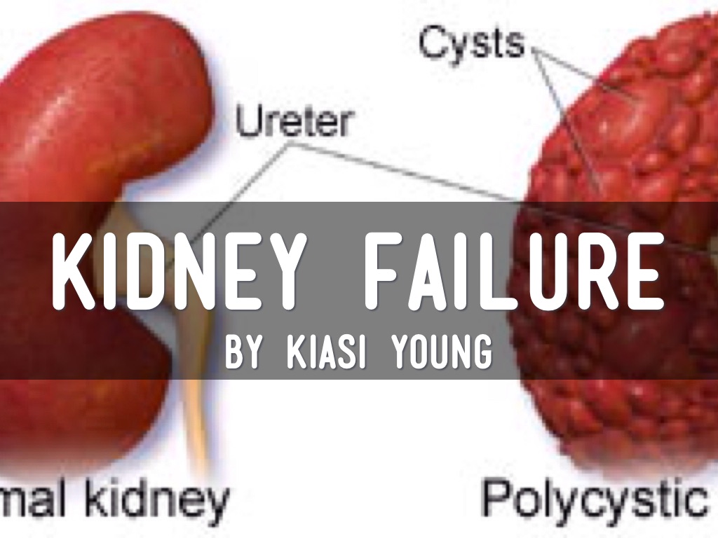 Kidney Disease by Kiasi Young