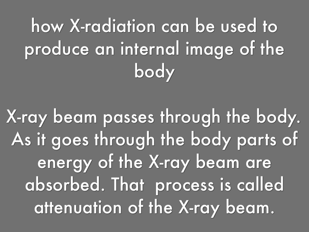 XRays by Isabella Dunn