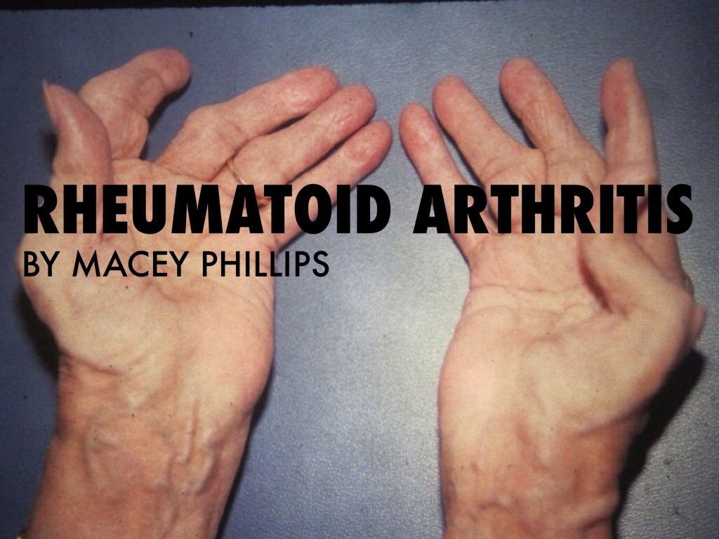 RA by Macey Phillips