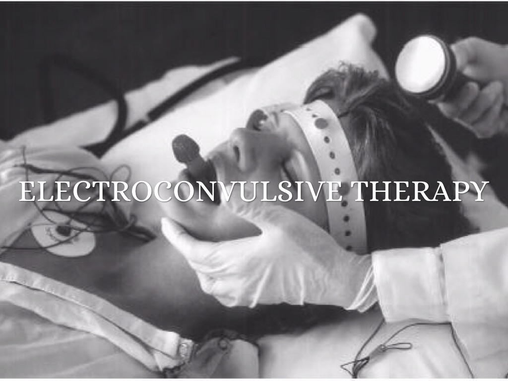 Electroconvulsive Therapy 