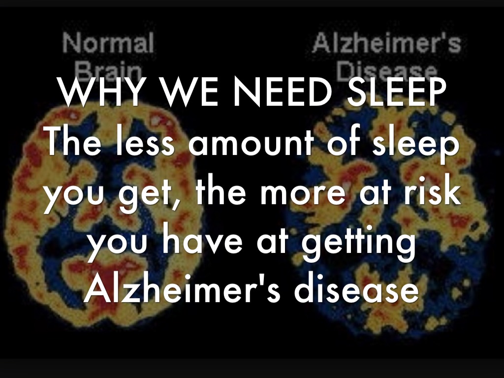 Why Do We Sleep by Katie Barnwell