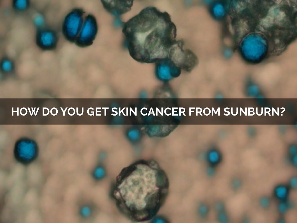 Sgoreckisummer by Sammie Gorecki