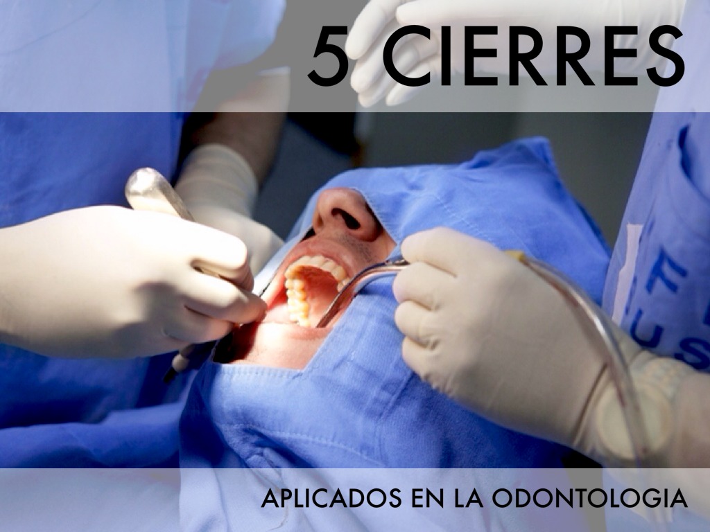 5 Cierres 