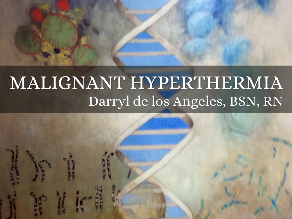 malignant hyperthermia