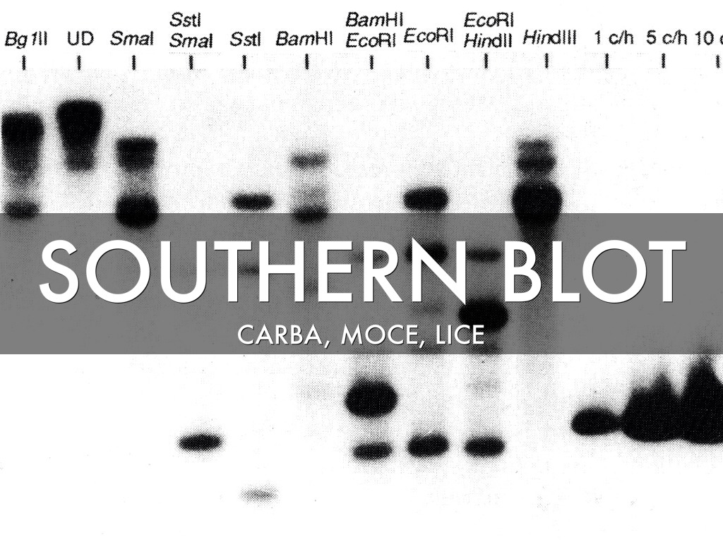Southern Blot