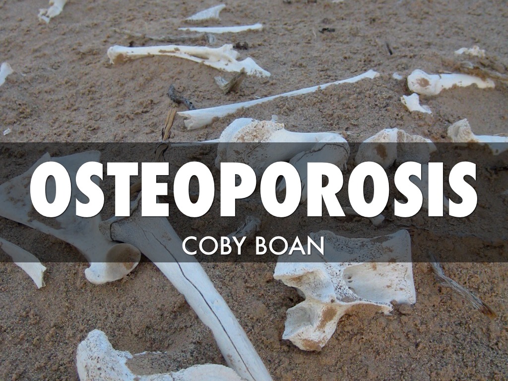 Osteoporosis