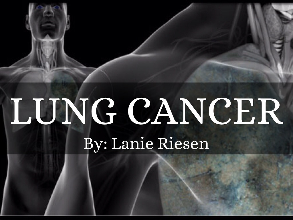 Lung Cancer
