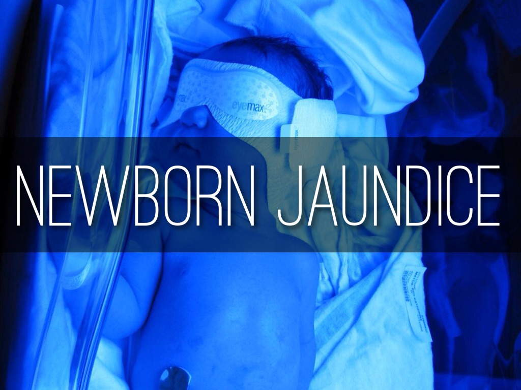 Copy of Newborn Jaundice