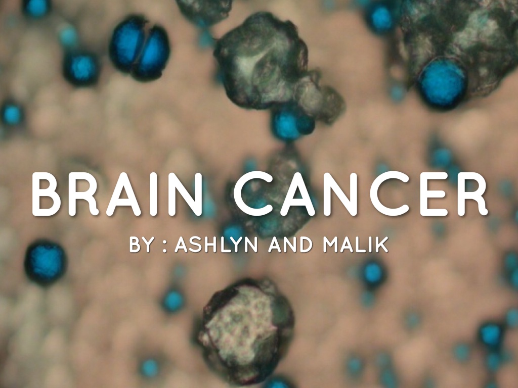 Brain Cancer