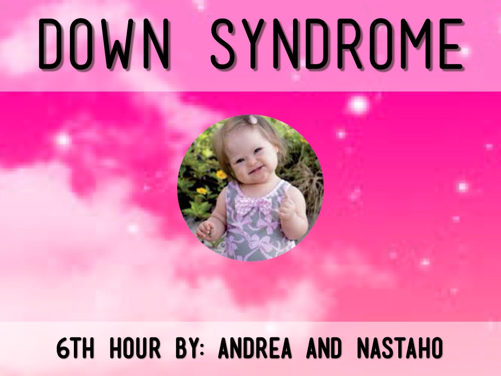 Down Syndrome 