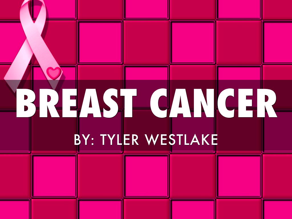 Breast Cancer