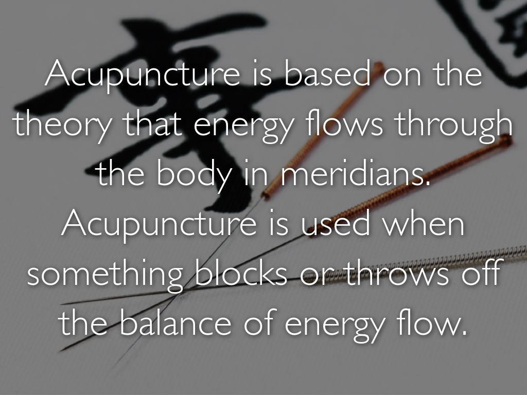 Acupuncture by Emily Donovan