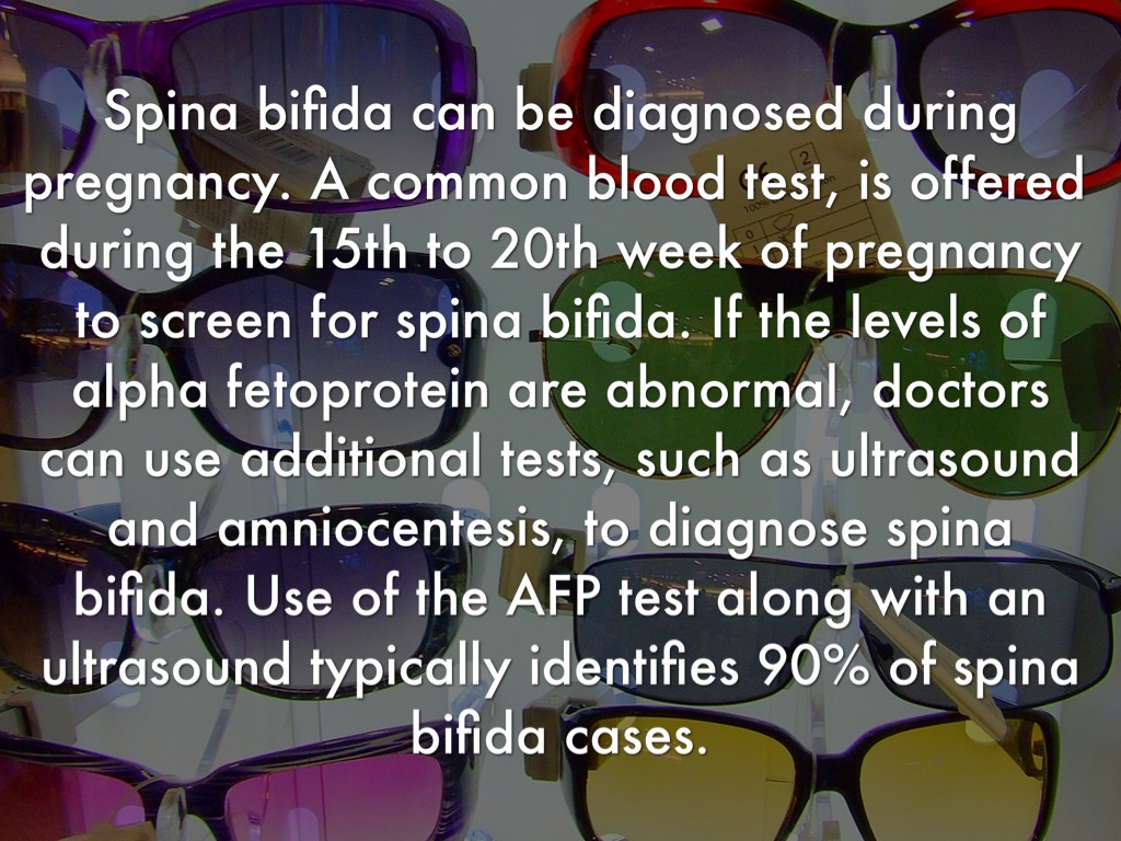 Spina Bifida by Becca Allen