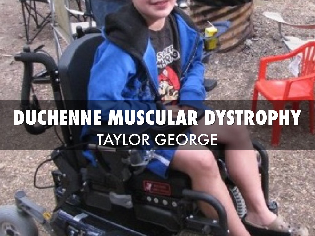 Duchenne Muscular Dystrophy 