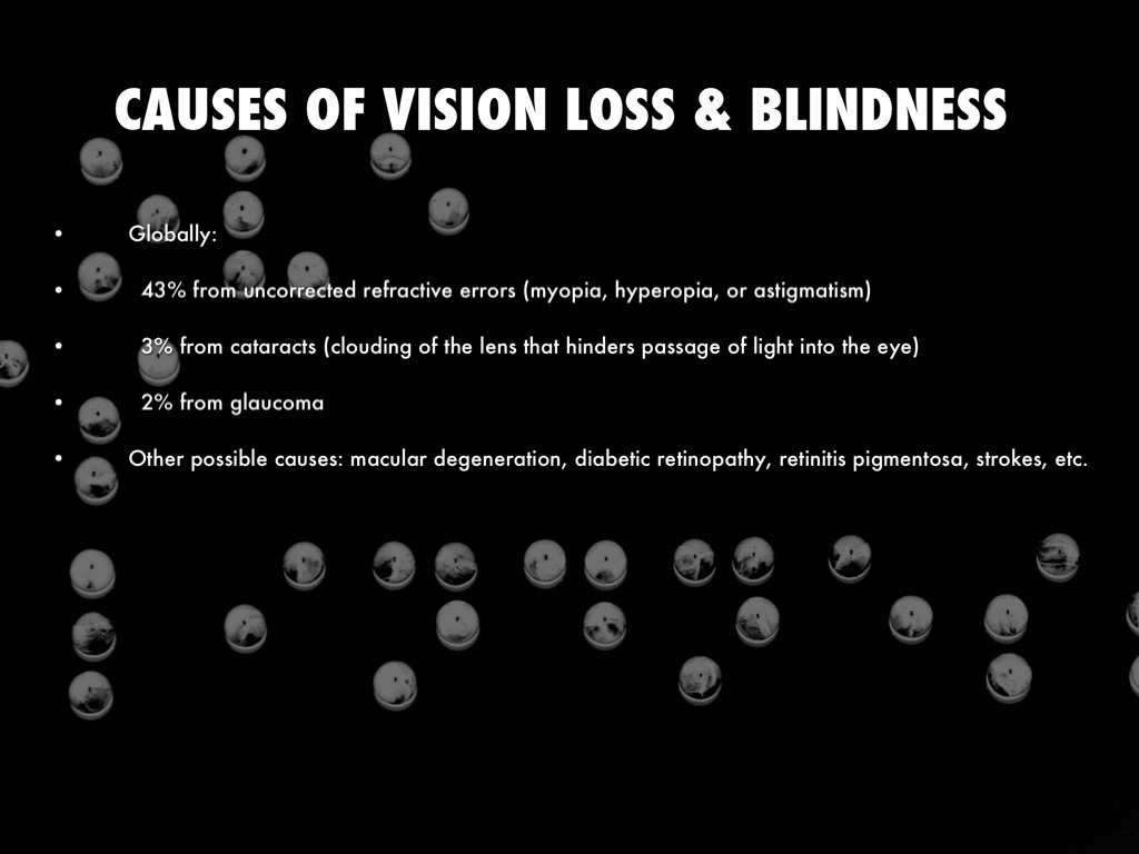 Vision Loss and Blindness by V K