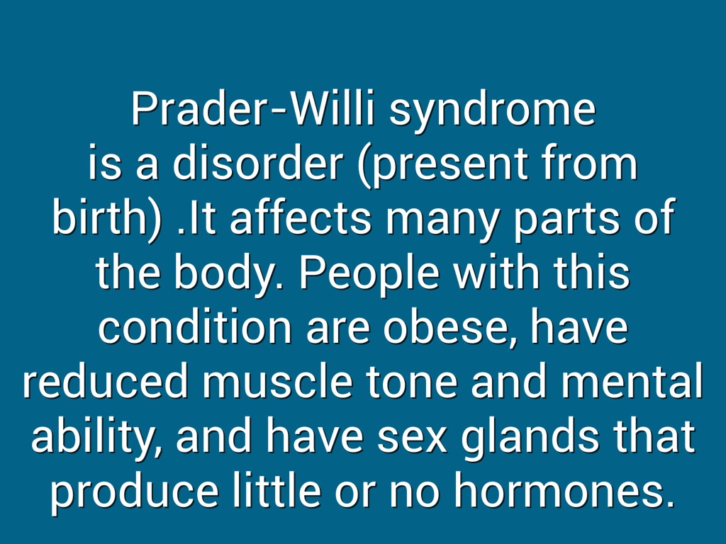 Prader Willi Syndrome