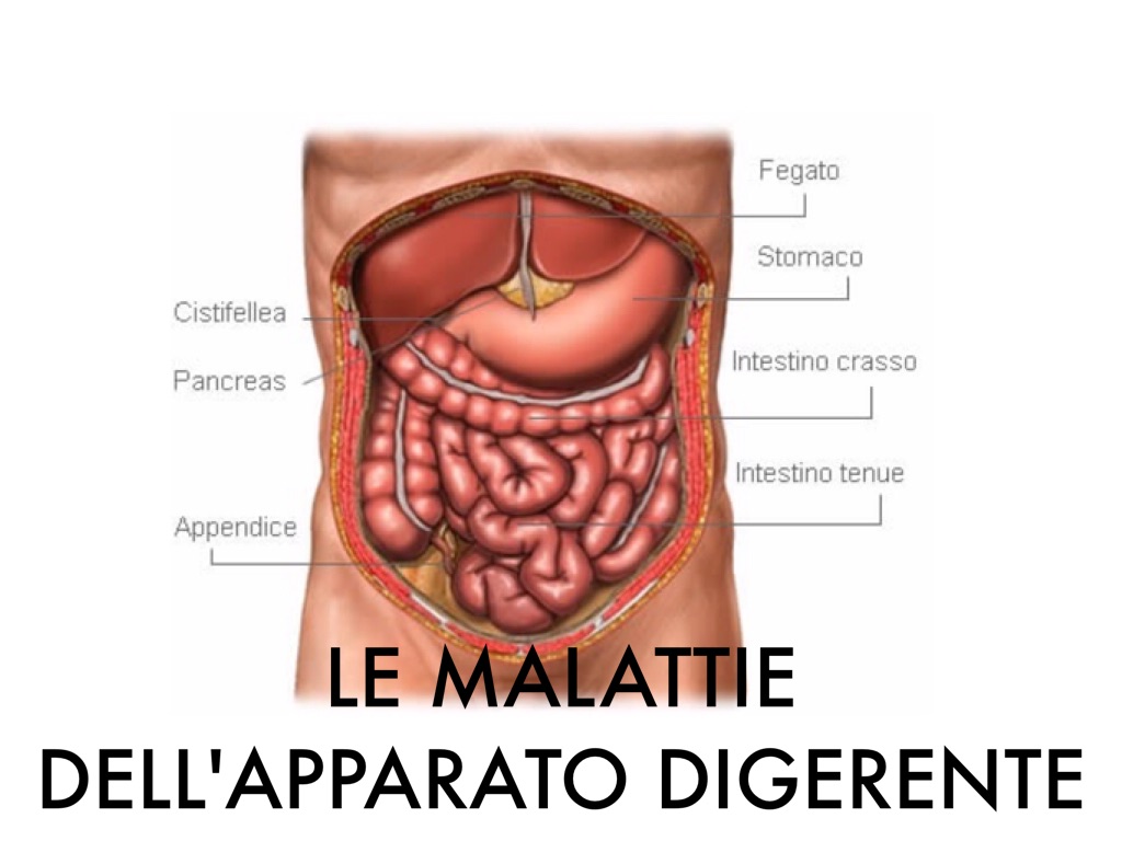 LE MALATTIE DELL'APPARATO DIGERENTE 
