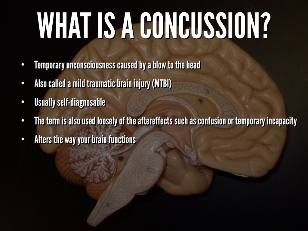 Concussions by Chandler Rankin