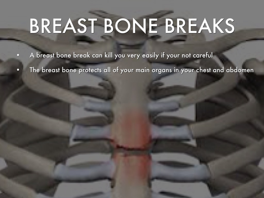 Bones by eric_mendes95