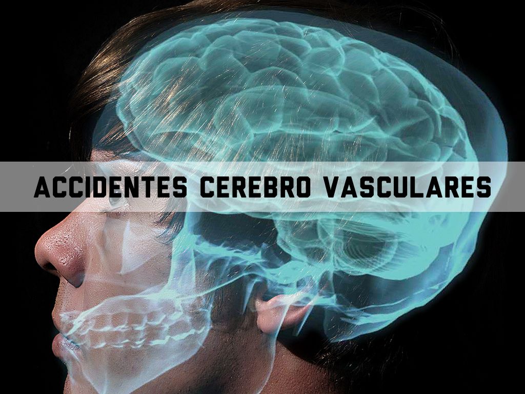 Copia de Copia de Acv