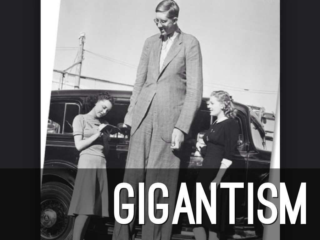 GIGANTISM