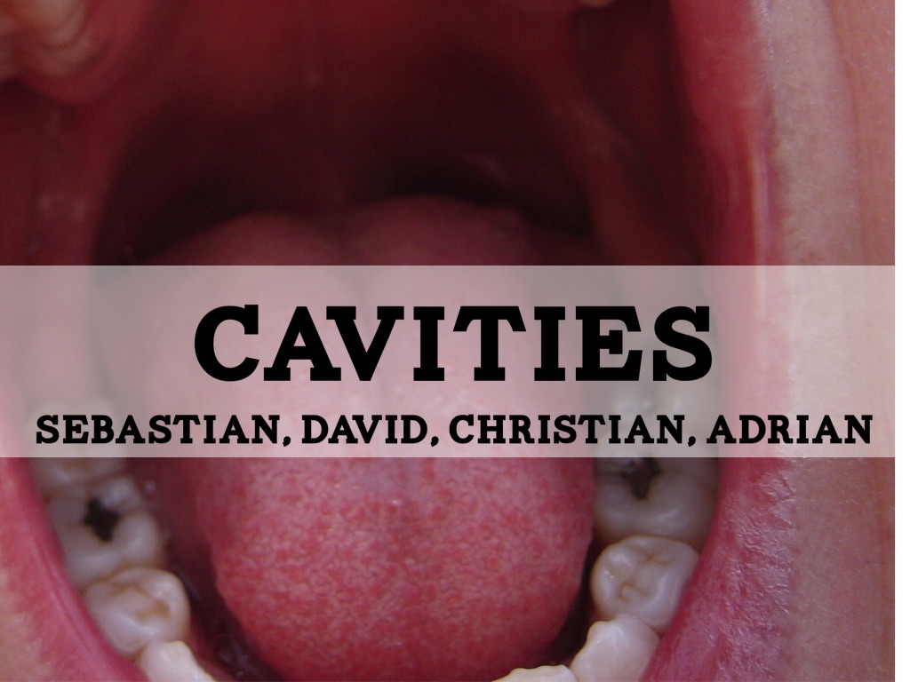 Cavities