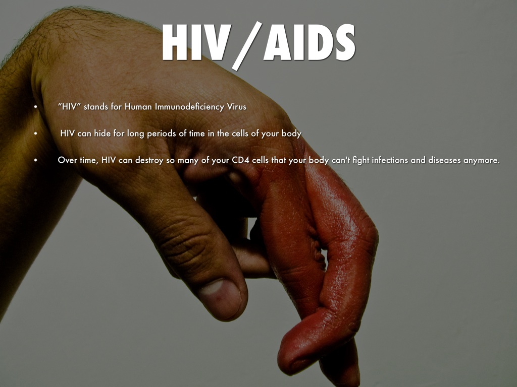 HIV/AIDS 