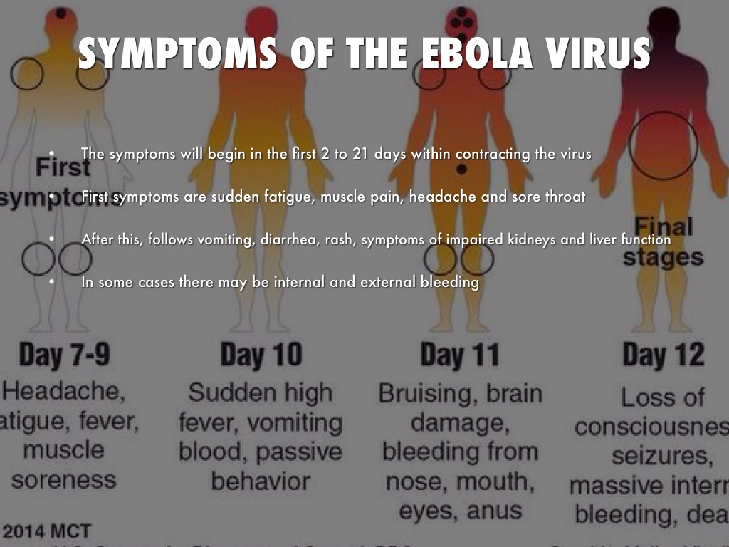 Ebola Virus by Megan Smith