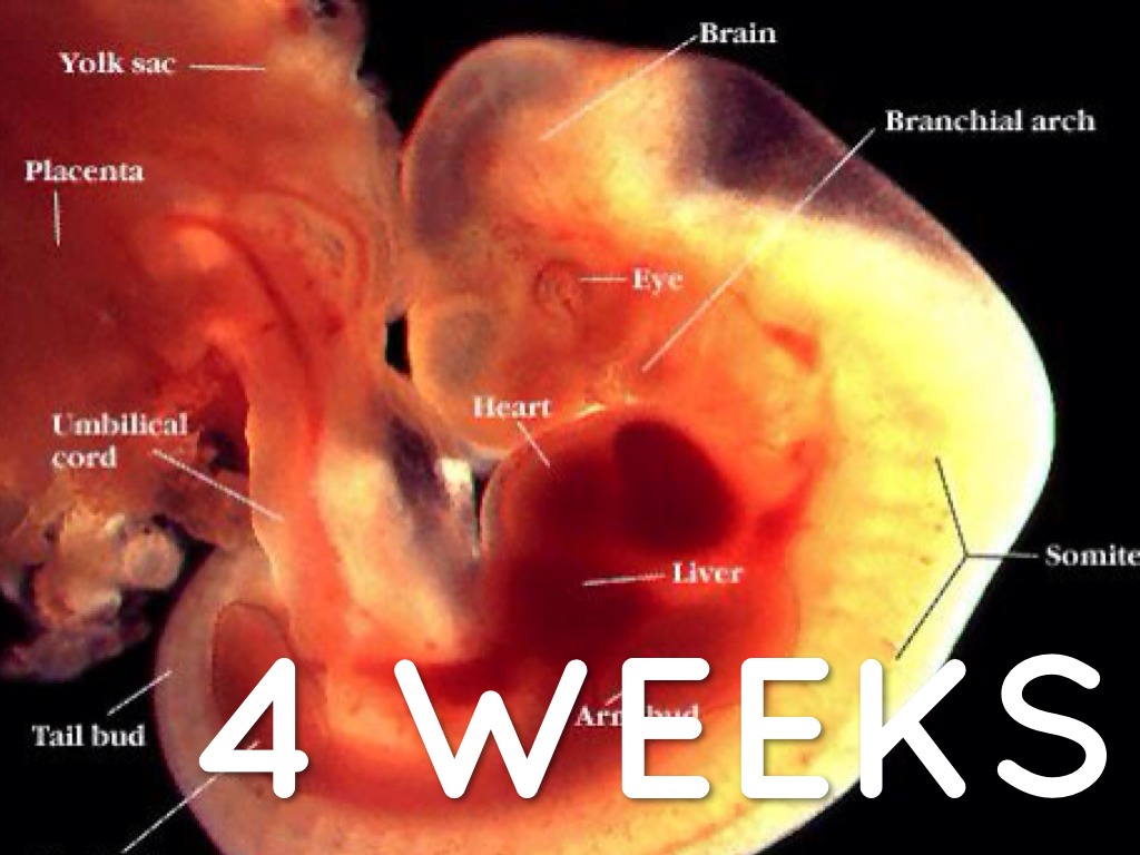 no heartbeat at 6 weeks