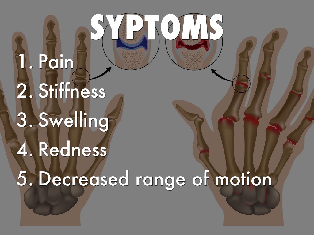 Arthritis by Cole Monson