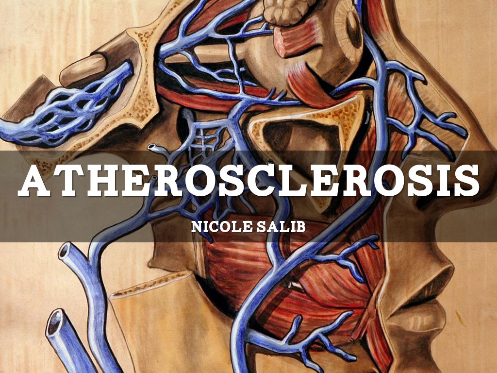 atherosclerosis