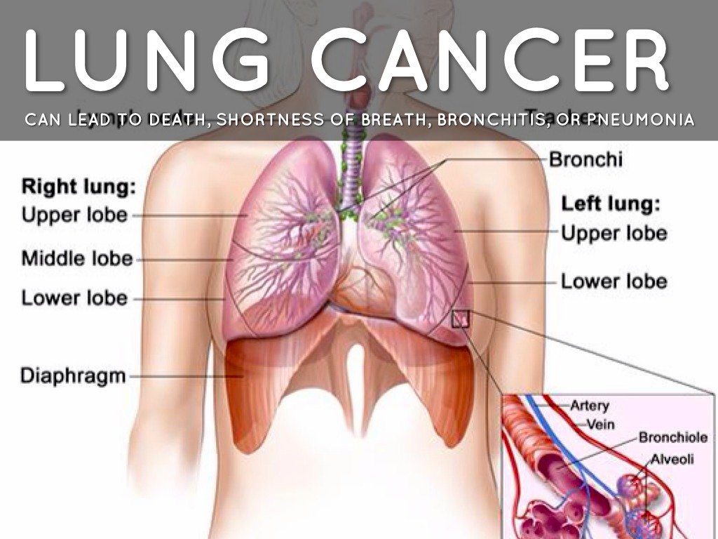 dead space examples diseases lungs